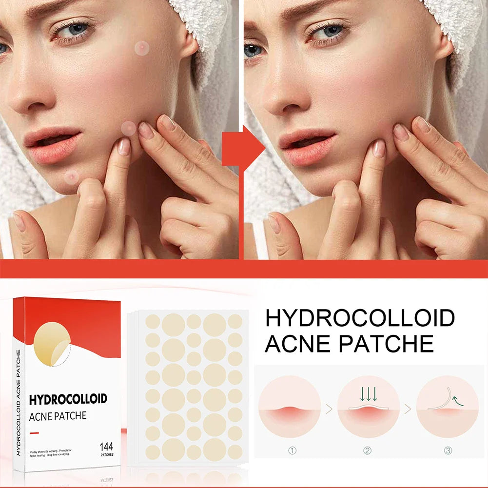 Invisible Acne Healing Patches