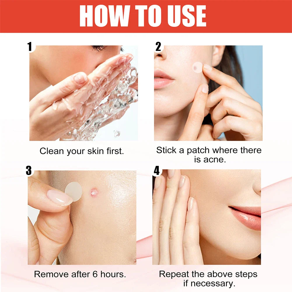 Invisible Acne Healing Patches